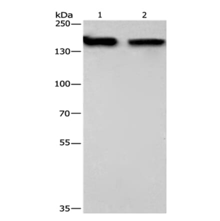 NCAPD2 Antibody from Signalway Antibody (36305) - Antibodies.com