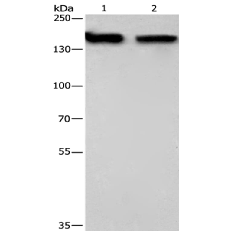 NCAPD2 Antibody from Signalway Antibody (36305) - Antibodies.com