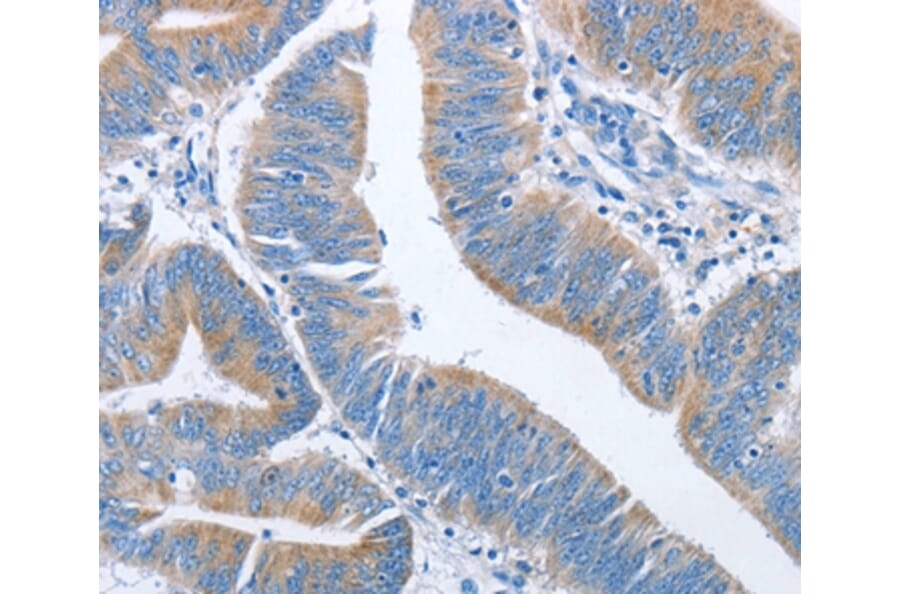 Immunohistochemistry - NCAPD2 Antibody from Signalway Antibody (36305) - Antibodies.com