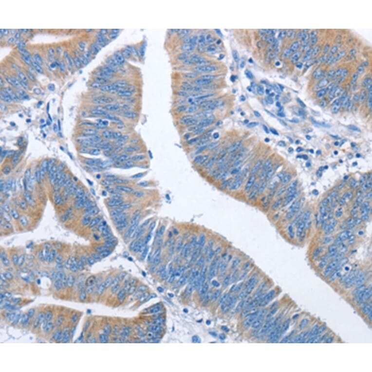 Immunohistochemistry - NCAPD2 Antibody from Signalway Antibody (36305) - Antibodies.com