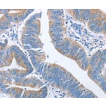 Immunohistochemistry - NCAPD2 Antibody from Signalway Antibody (36305) - Antibodies.com