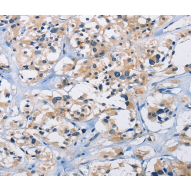 Immunohistochemistry - CARD14 Antibody from Signalway Antibody (36310) - Antibodies.com