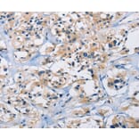 Immunohistochemistry - CARD14 Antibody from Signalway Antibody (36310) - Antibodies.com