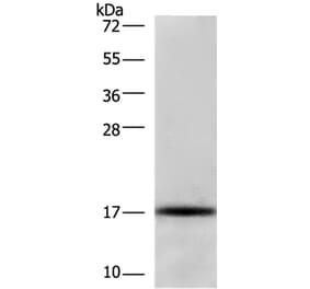 CDKN2C Antibody from Signalway Antibody (36336) - Antibodies.com