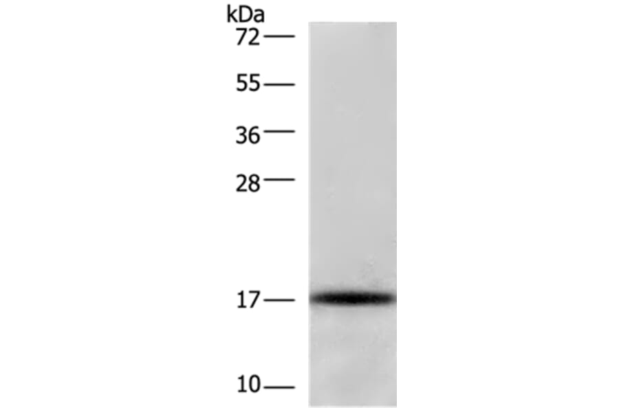 CDKN2C Antibody from Signalway Antibody (36336) - Antibodies.com
