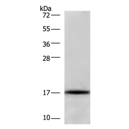 CDKN2C Antibody from Signalway Antibody (36336) - Antibodies.com