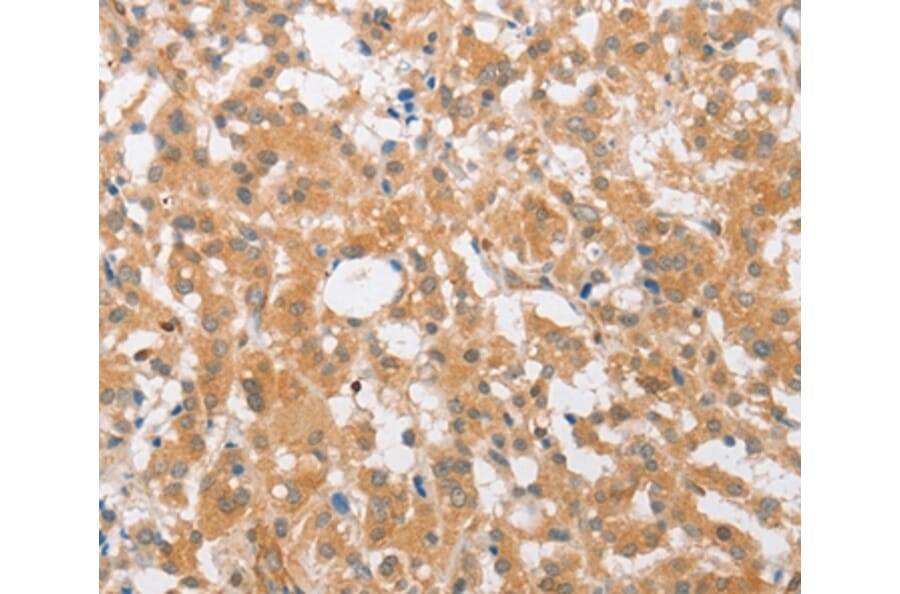 Immunohistochemistry - CDKN2C Antibody from Signalway Antibody (36336) - Antibodies.com