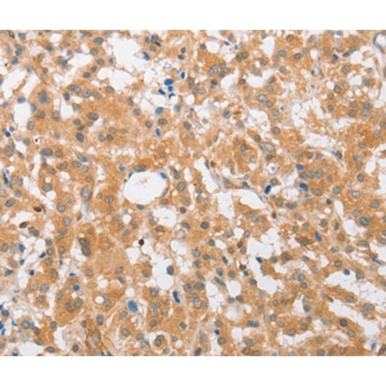 Immunohistochemistry - CDKN2C Antibody from Signalway Antibody (36336) - Antibodies.com