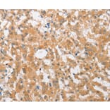 Immunohistochemistry - CDKN2C Antibody from Signalway Antibody (36336) - Antibodies.com