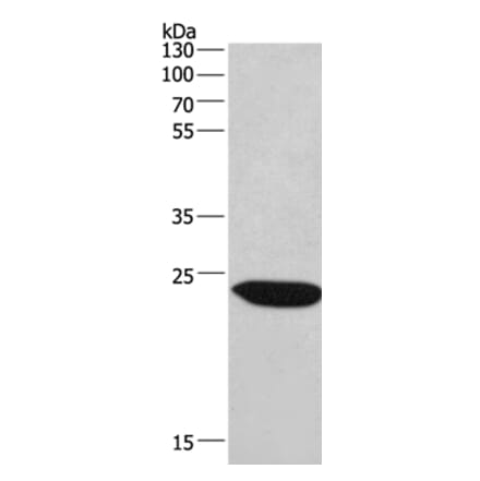 CHMP1A Antibody from Signalway Antibody (36349) - Antibodies.com