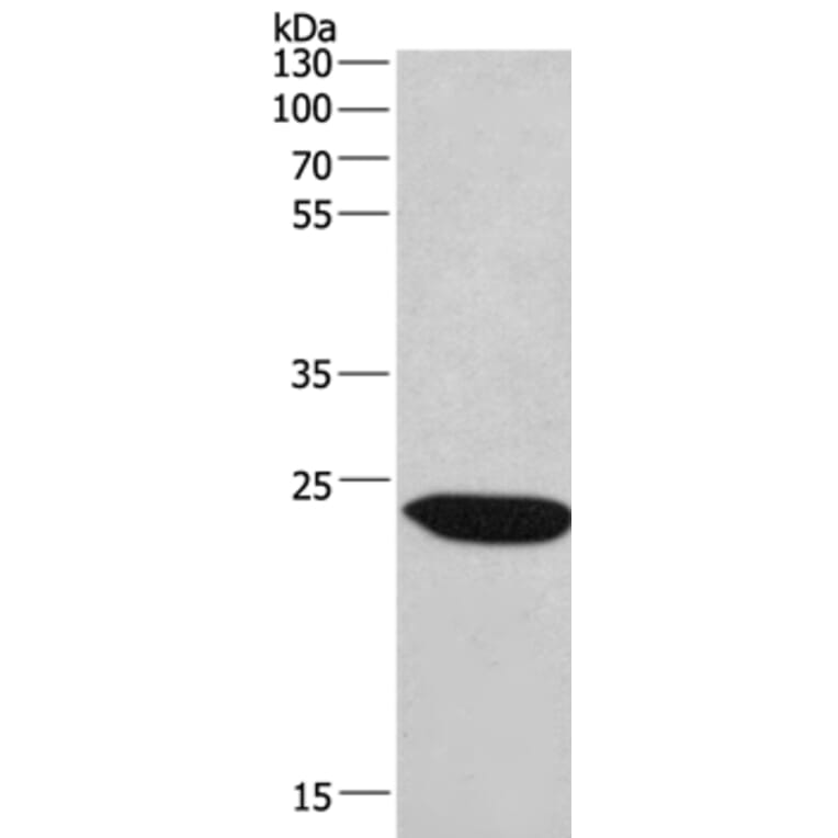 CHMP1A Antibody from Signalway Antibody (36349) - Antibodies.com