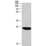 CHMP1A Antibody from Signalway Antibody (36349) - Antibodies.com