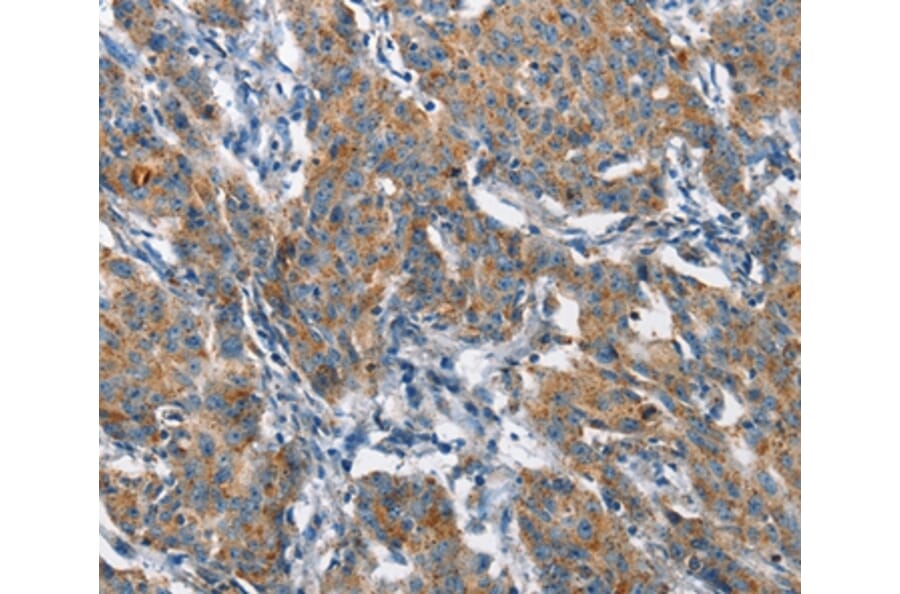 Immunohistochemistry - CHMP1A Antibody from Signalway Antibody (36349) - Antibodies.com