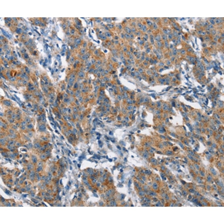 Immunohistochemistry - CHMP1A Antibody from Signalway Antibody (36349) - Antibodies.com