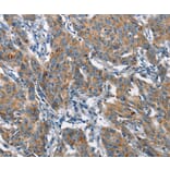 Immunohistochemistry - CHMP1A Antibody from Signalway Antibody (36349) - Antibodies.com