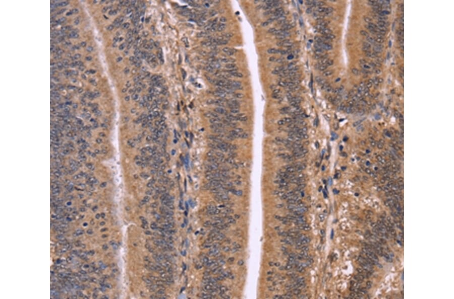 Immunohistochemistry - CLUAP1 Antibody from Signalway Antibody (36358) - Antibodies.com