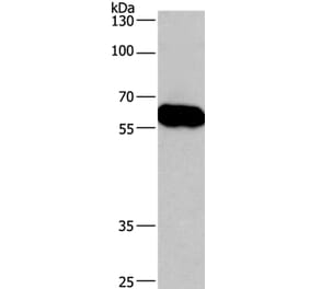 CORO1C Antibody from Signalway Antibody (36363) - Antibodies.com