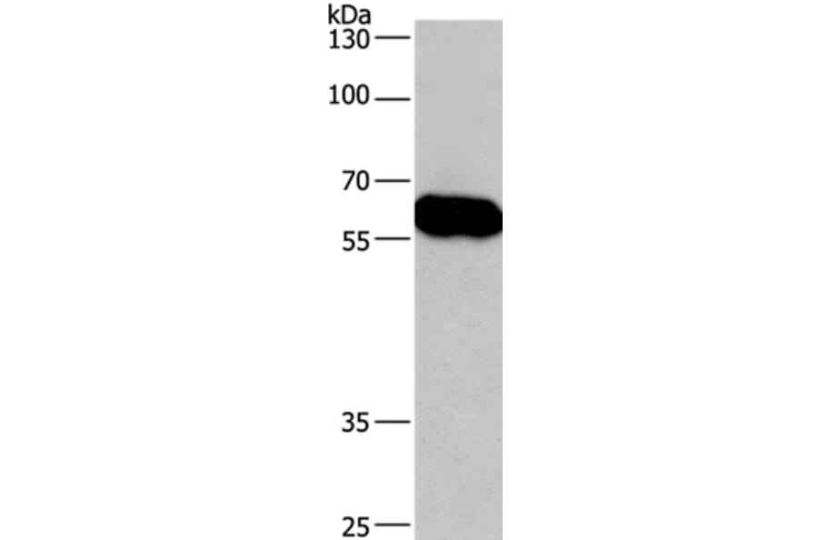 CORO1C Antibody from Signalway Antibody (36363) - Antibodies.com
