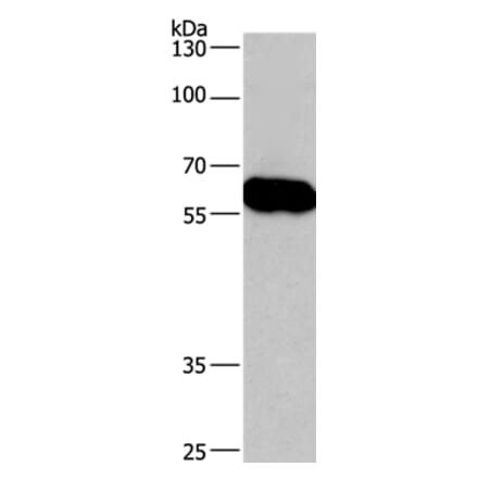CORO1C Antibody from Signalway Antibody (36363) - Antibodies.com