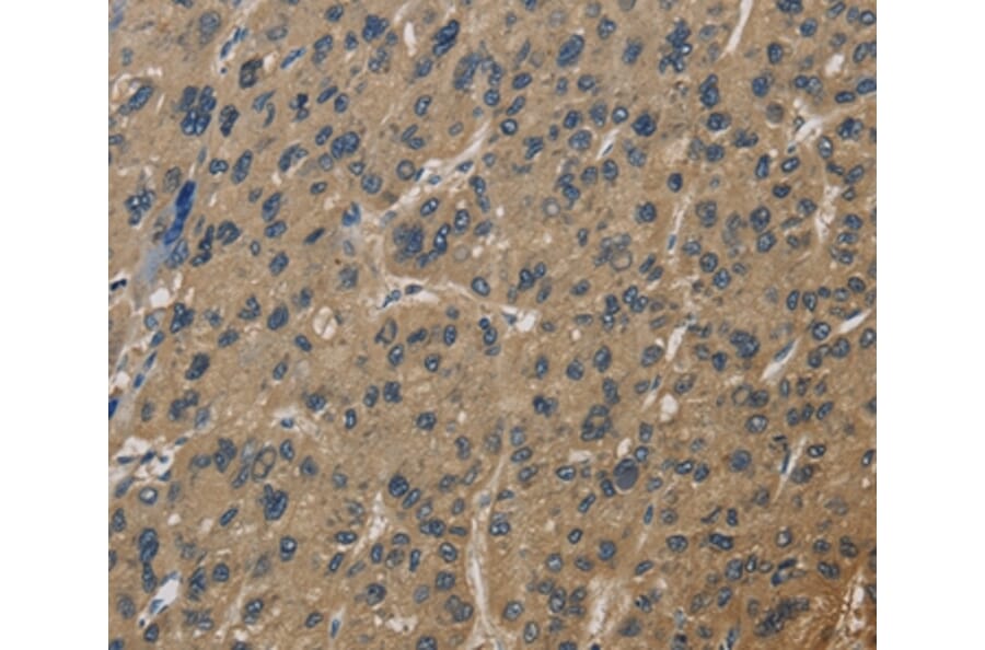 Immunohistochemistry - CORO1C Antibody from Signalway Antibody (36363) - Antibodies.com