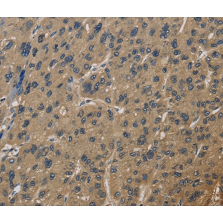 Immunohistochemistry - CORO1C Antibody from Signalway Antibody (36363) - Antibodies.com