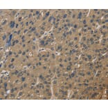 Immunohistochemistry - CORO1C Antibody from Signalway Antibody (36363) - Antibodies.com