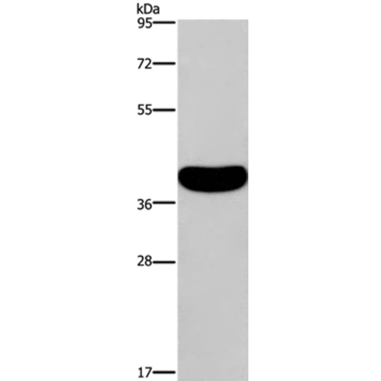 CRELD2 Antibody from Signalway Antibody (36370) - Antibodies.com