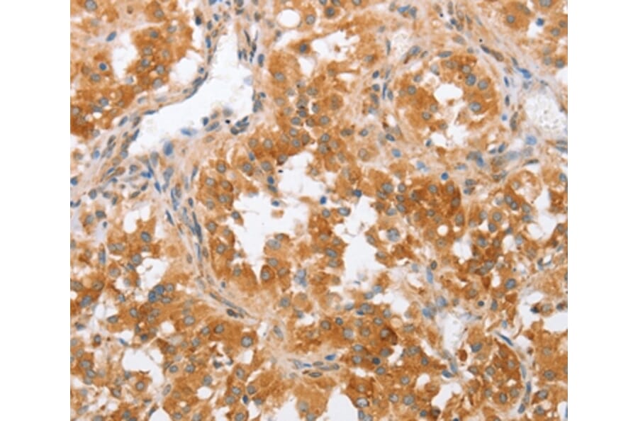 Immunohistochemistry - CRELD2 Antibody from Signalway Antibody (36370) - Antibodies.com