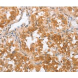 Immunohistochemistry - CRELD2 Antibody from Signalway Antibody (36370) - Antibodies.com