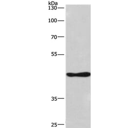 CSNK1D Antibody from Signalway Antibody (36374) - Antibodies.com