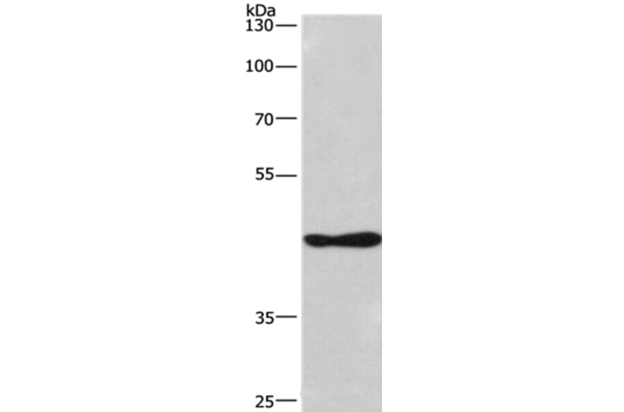 CSNK1D Antibody from Signalway Antibody (36374) - Antibodies.com