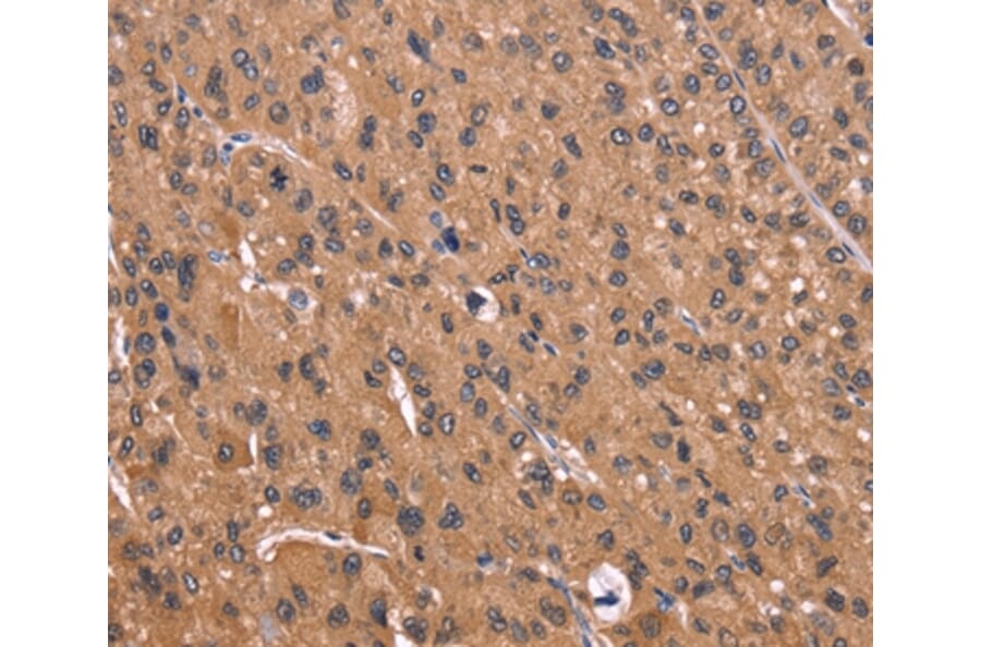 Immunohistochemistry - CSNK1D Antibody from Signalway Antibody (36374) - Antibodies.com
