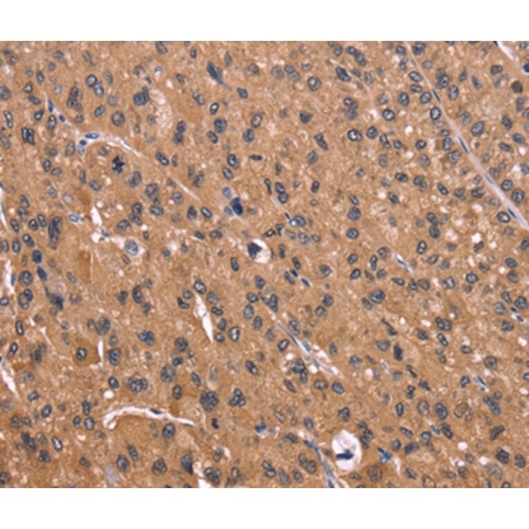 Immunohistochemistry - CSNK1D Antibody from Signalway Antibody (36374) - Antibodies.com
