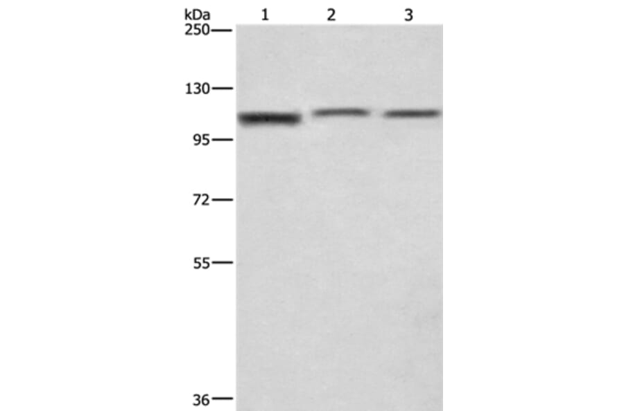 CTAGE5 Antibody from Signalway Antibody (36375) - Antibodies.com
