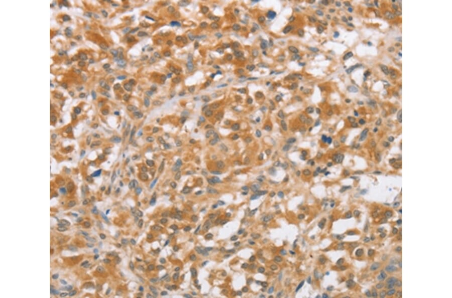 Immunohistochemistry - CTAGE5 Antibody from Signalway Antibody (36375) - Antibodies.com