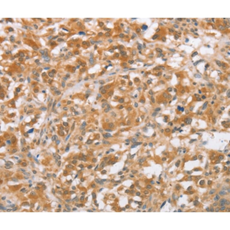 Immunohistochemistry - CTAGE5 Antibody from Signalway Antibody (36375) - Antibodies.com