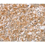 Immunohistochemistry - CTAGE5 Antibody from Signalway Antibody (36375) - Antibodies.com