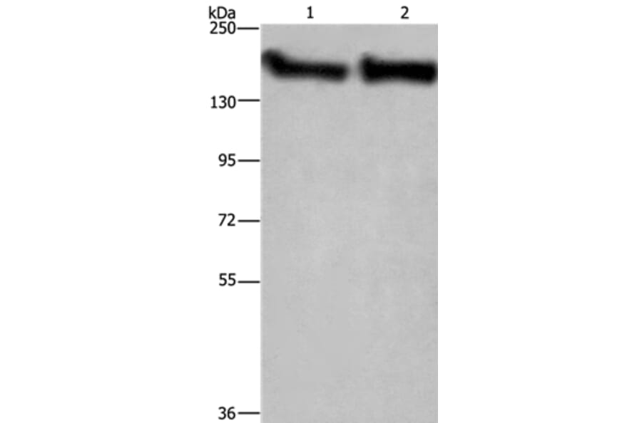 CYFIP2 Antibody from Signalway Antibody (36383) - Antibodies.com