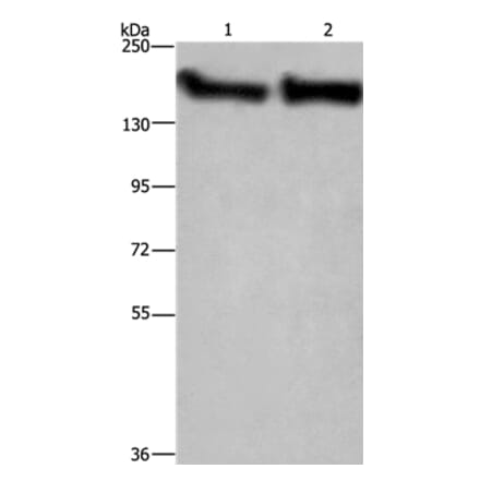 CYFIP2 Antibody from Signalway Antibody (36383) - Antibodies.com