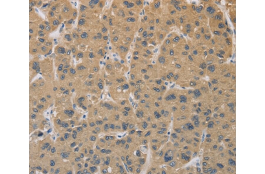 Immunohistochemistry - CYFIP2 Antibody from Signalway Antibody (36383) - Antibodies.com