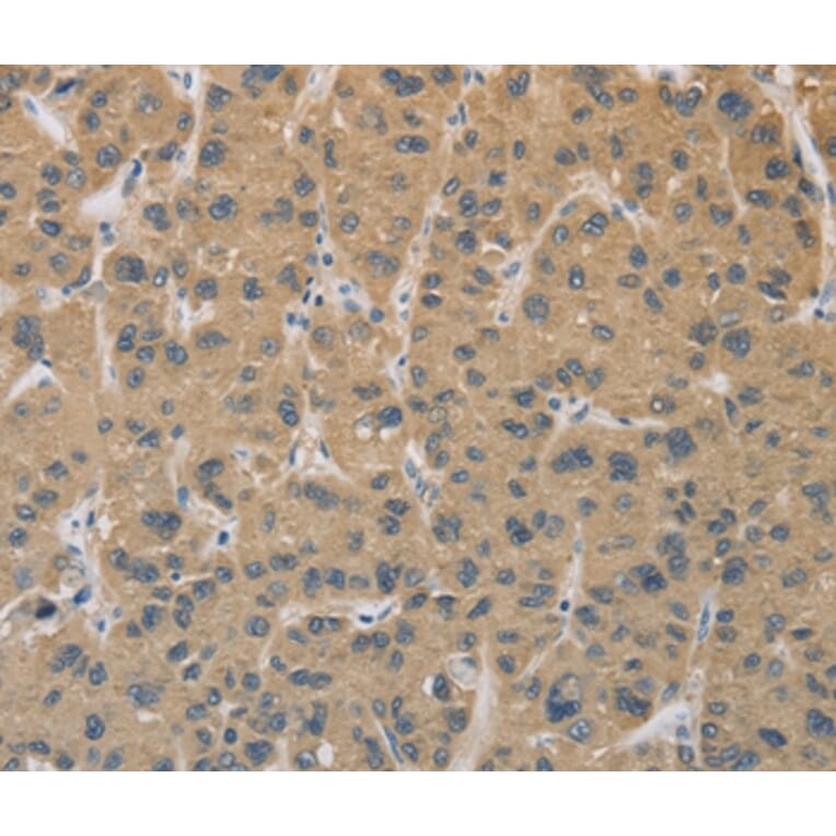 Immunohistochemistry - CYFIP2 Antibody from Signalway Antibody (36383) - Antibodies.com