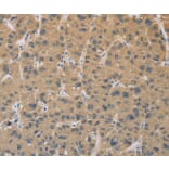 Immunohistochemistry - CYFIP2 Antibody from Signalway Antibody (36383) - Antibodies.com