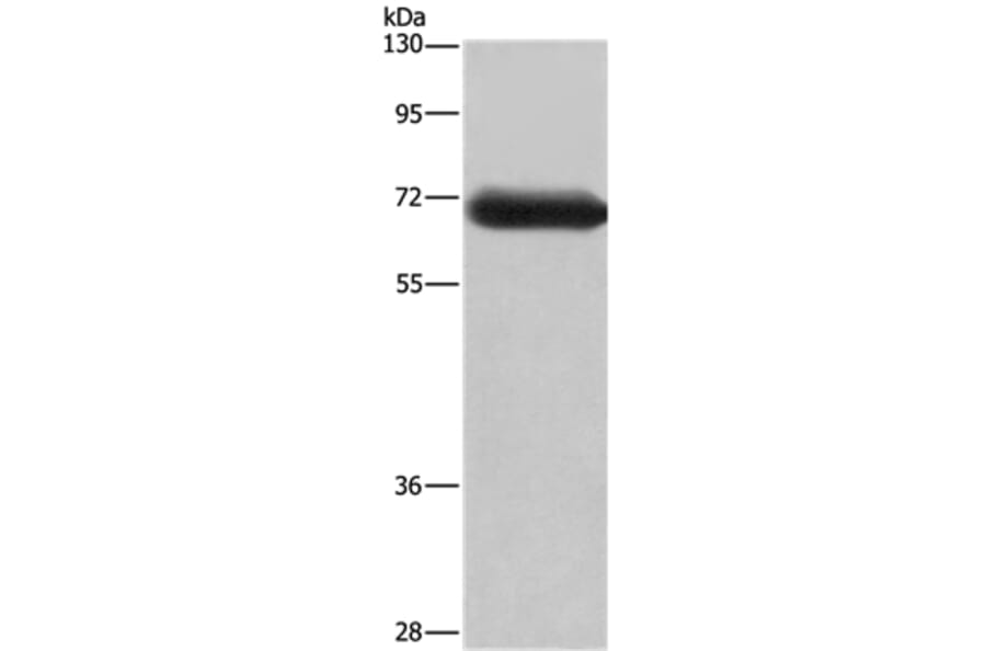 DPYSL3 Antibody from Signalway Antibody (36424) - Antibodies.com