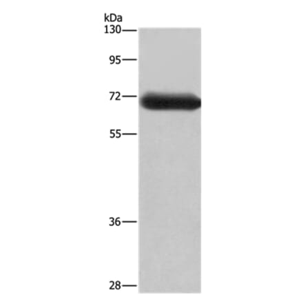 DPYSL3 Antibody from Signalway Antibody (36424) - Antibodies.com