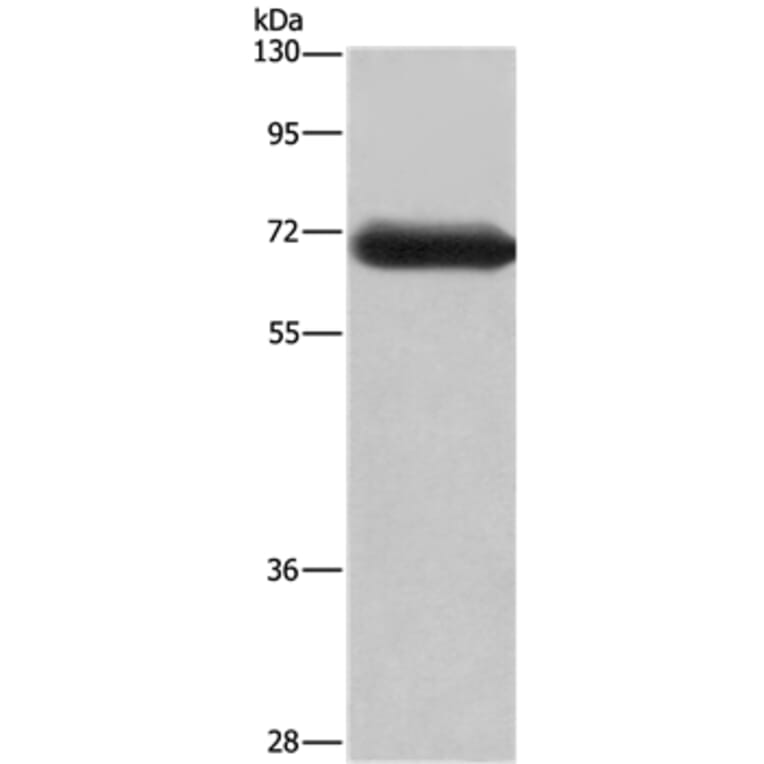DPYSL3 Antibody from Signalway Antibody (36424) - Antibodies.com