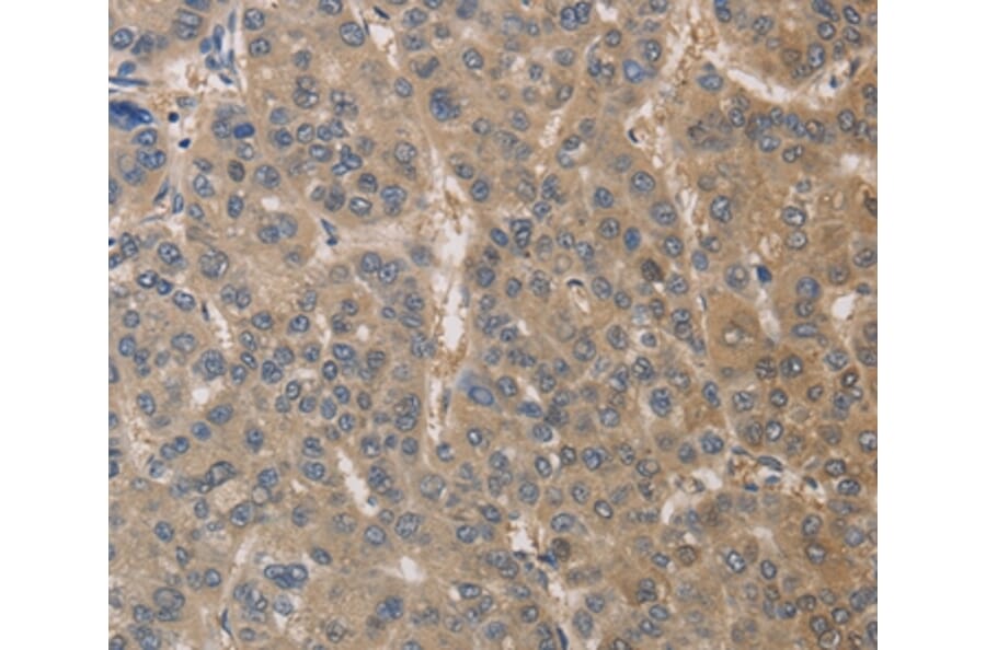 Immunohistochemistry - DPYSL3 Antibody from Signalway Antibody (36424) - Antibodies.com