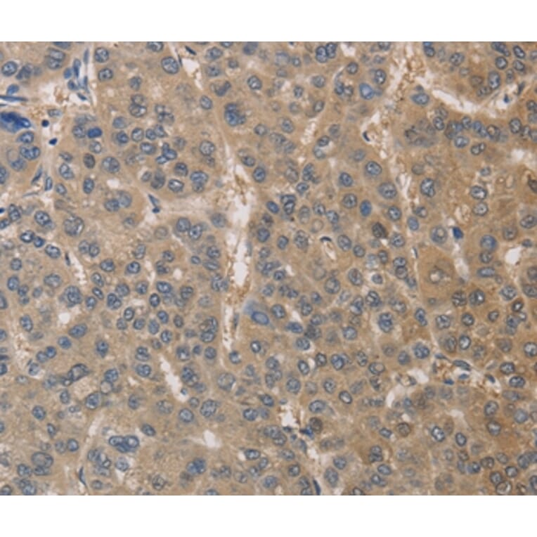 Immunohistochemistry - DPYSL3 Antibody from Signalway Antibody (36424) - Antibodies.com