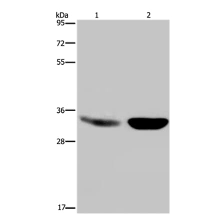 MAPRE3 Antibody from Signalway Antibody (36430) - Antibodies.com