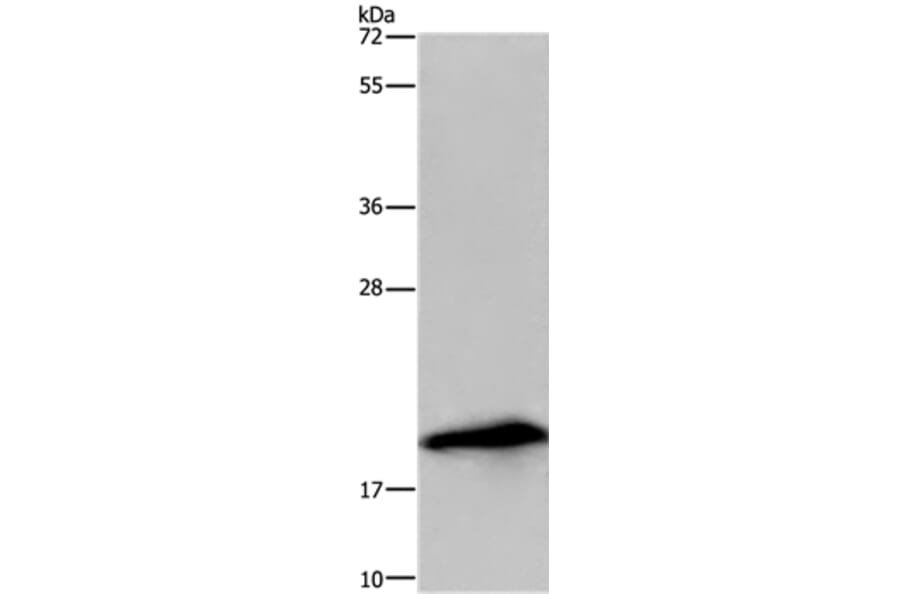 RNASE3 Antibody from Signalway Antibody (36432) - Antibodies.com
