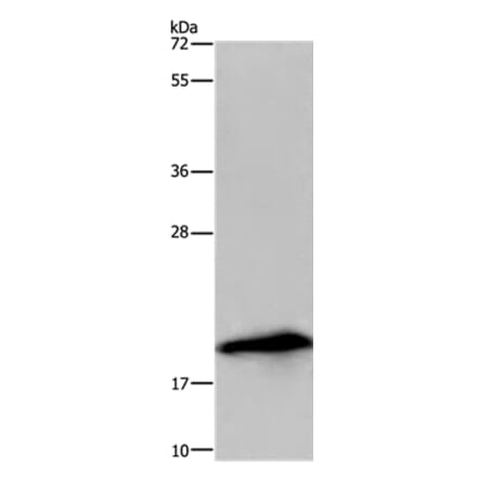 RNASE3 Antibody from Signalway Antibody (36432) - Antibodies.com